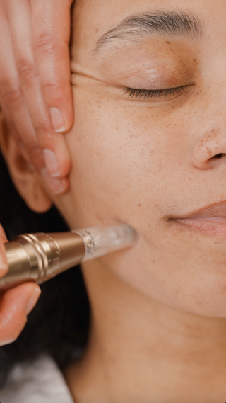 What is Nano-Dermabrasion?